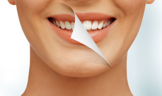 tooth whitening