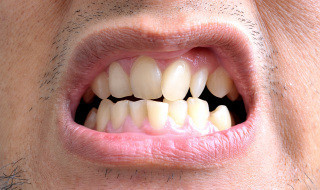 mouth