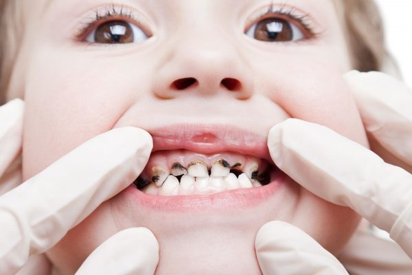 oral health