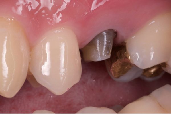 Amber Mill case study 2