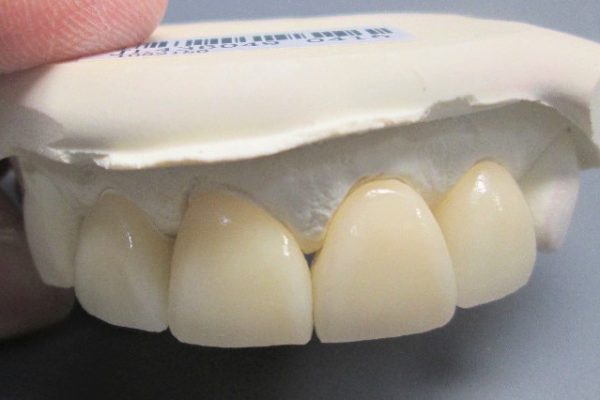 ultra-translucent zirconia