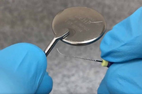 root canal treatment Figure 4: The tip of the size 10 hand file can be bent against the shaft of the mirror