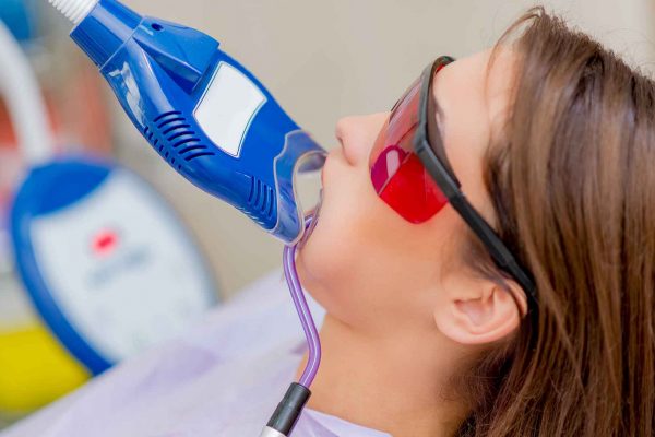 patient having zoom teeth whitening