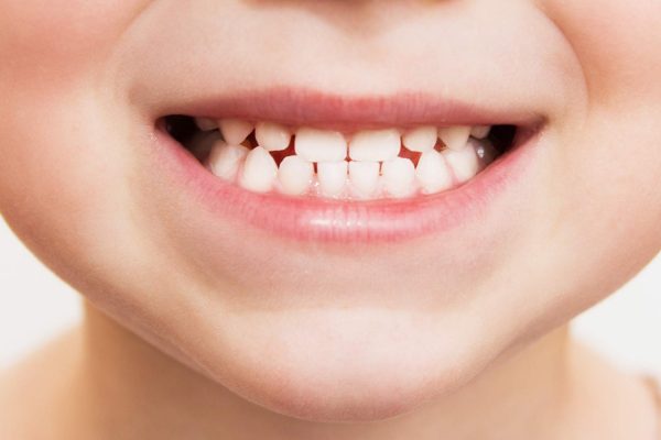 Almost one in eight children have woken up from a bad dream about their oral health, it has been revealed