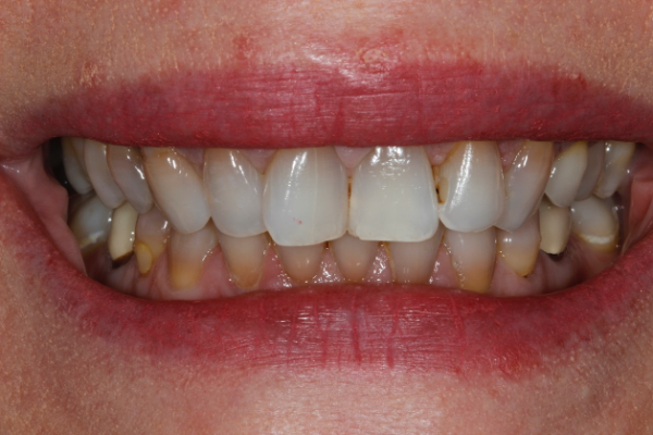 Figure 1a