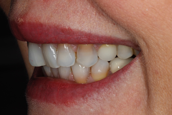 Figure 1b