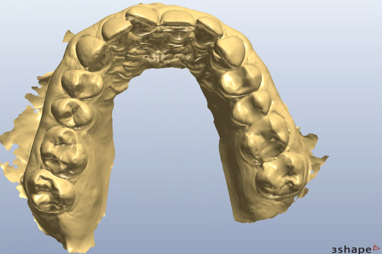 Figure 2a