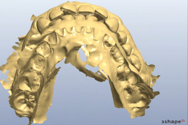 Figure 2b