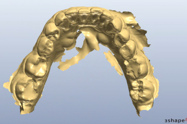Figure 2c
