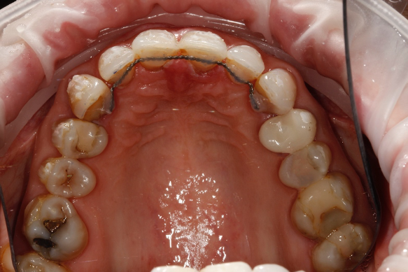 Figure 4a