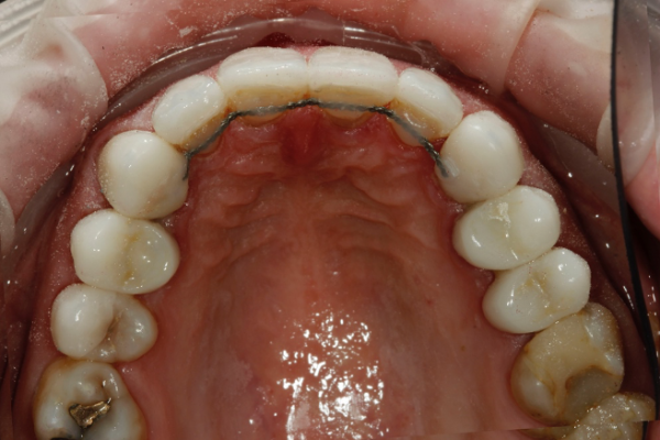 Figure 6d