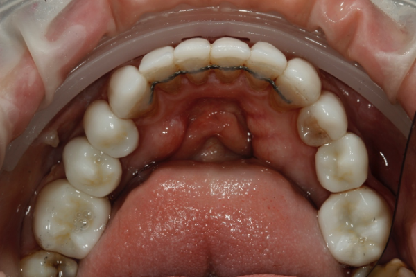 Figure 6e