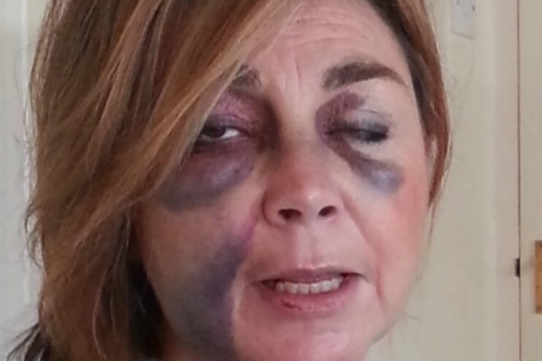 Sarah Thomson speaks about her road to recovery out of alcoholism