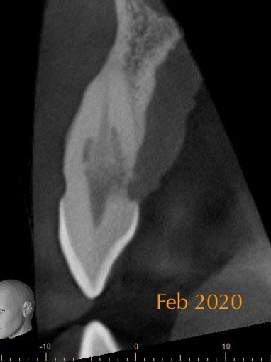 Figure 10b