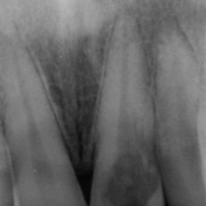 Figure 4a