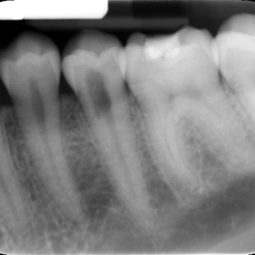 Figure 4c
