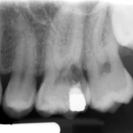 Figure 4d