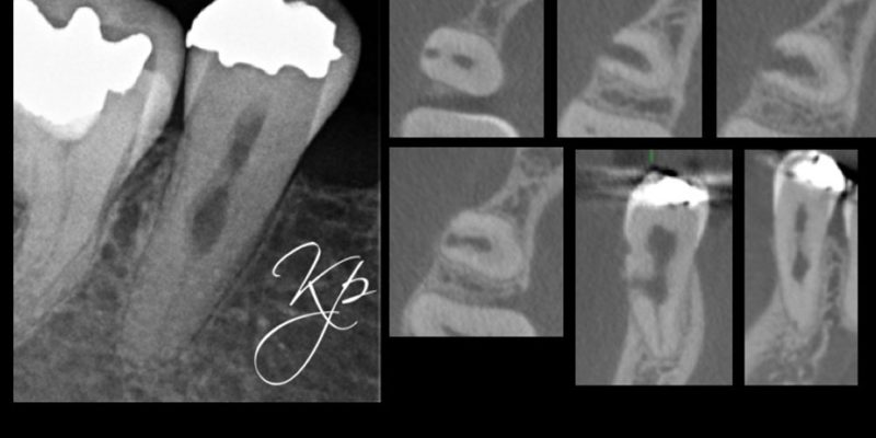 Figure 5a