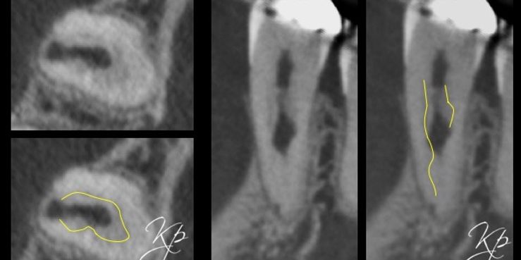 Figure 5b