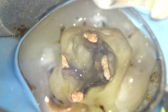 Figure 3c radix