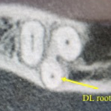 Figure 5b radix