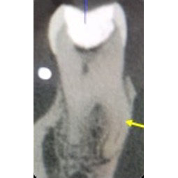 Figure-5c-2-radix