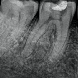 Figure 6a radix