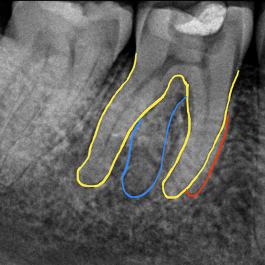 Figure 6b radix