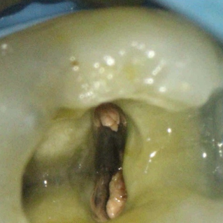 Figure 7d radix