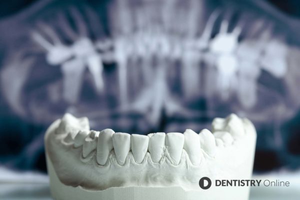 Chloe Barrett discusses the benefits of Immersify Education and how she hopes to transform the future of dental education