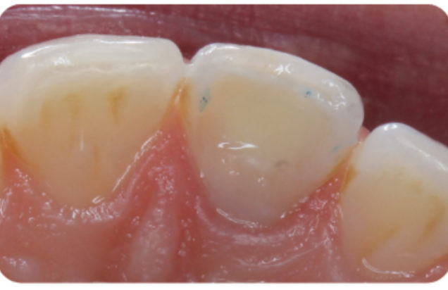 Figure-10b