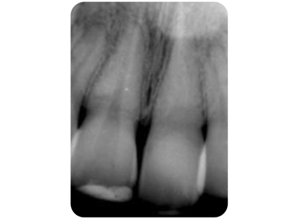 Figure-1b