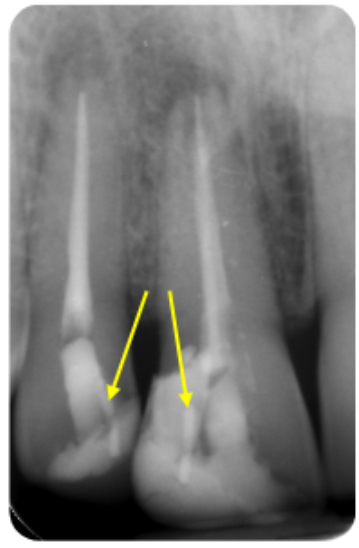 Figure-4a