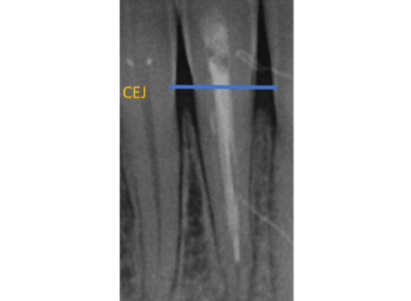Figure-5a