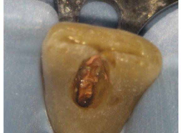 Figure-5b