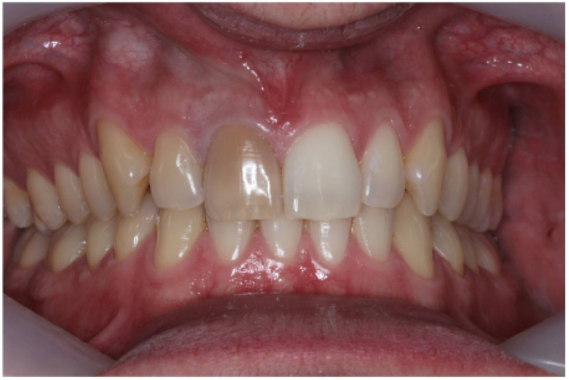Figure-6b