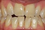 Picture 1