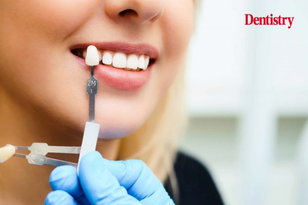 Tips for shade matching indirect restorations