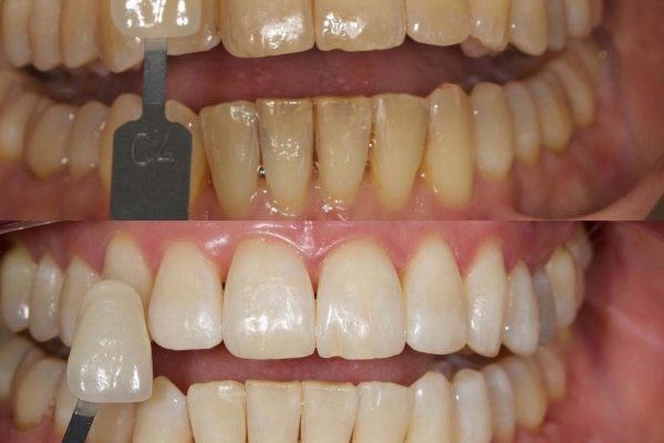 Biomin whitening