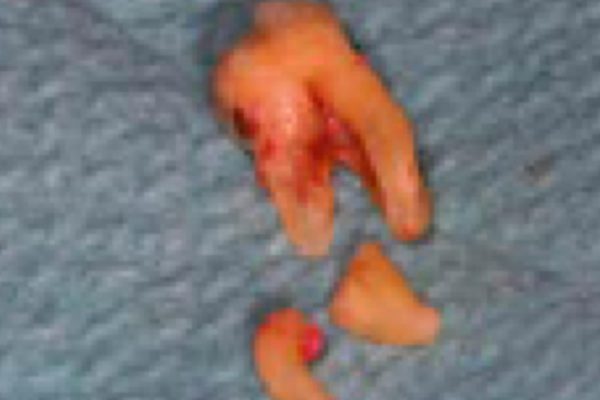 Figure-12