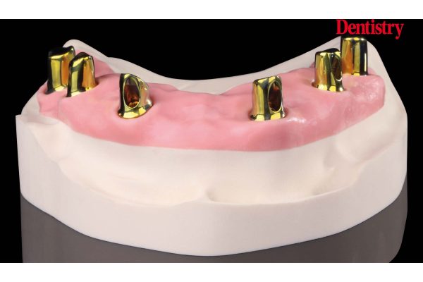 Raw-Abutments-2