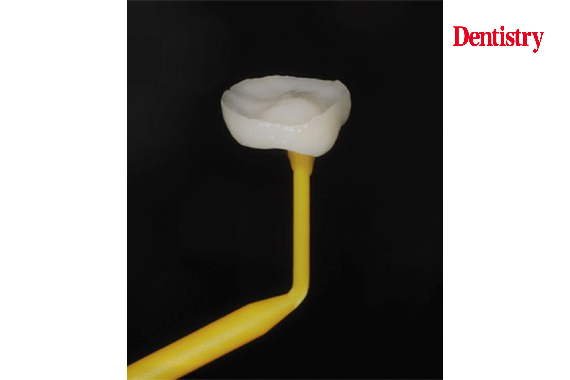 Lower-molar-figure-9