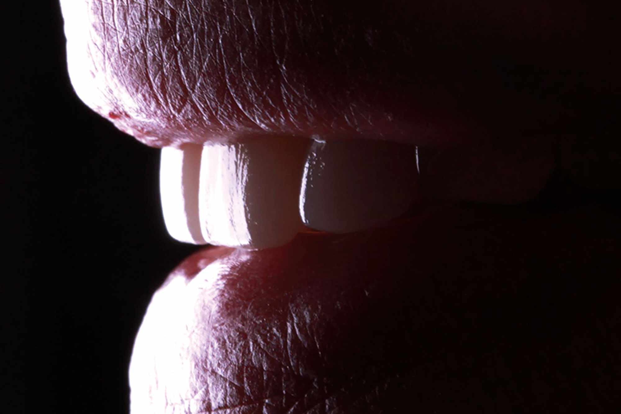 Figure-14