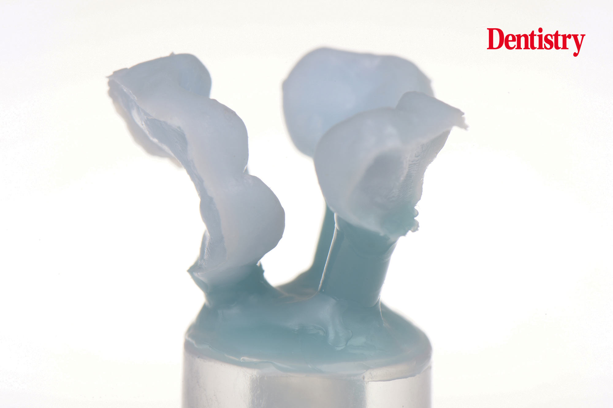 figure-61 Digital workflow: a game changer for implant restoration – part two