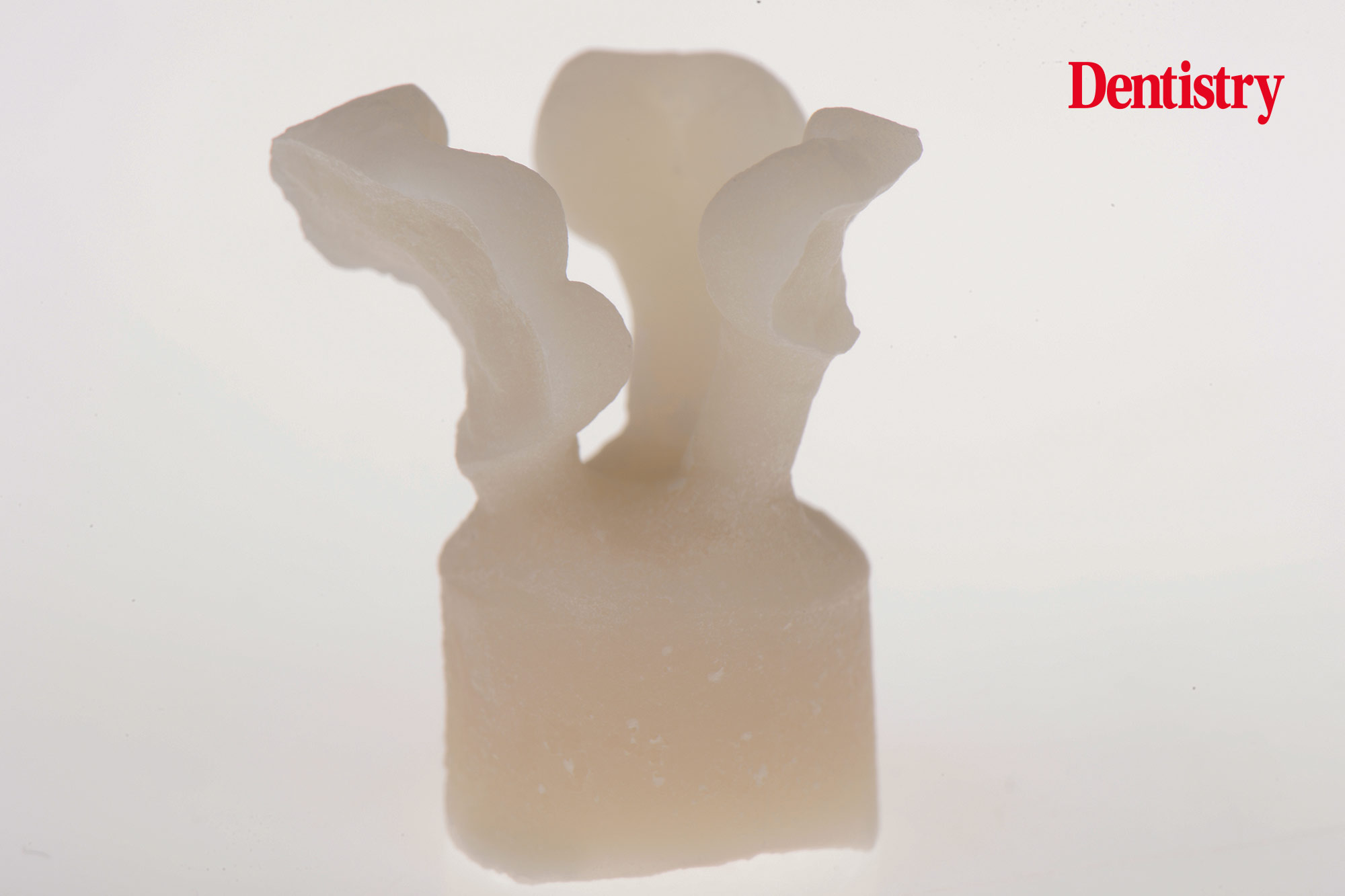 figure-63 Digital workflow: a game changer for implant restoration – part two
