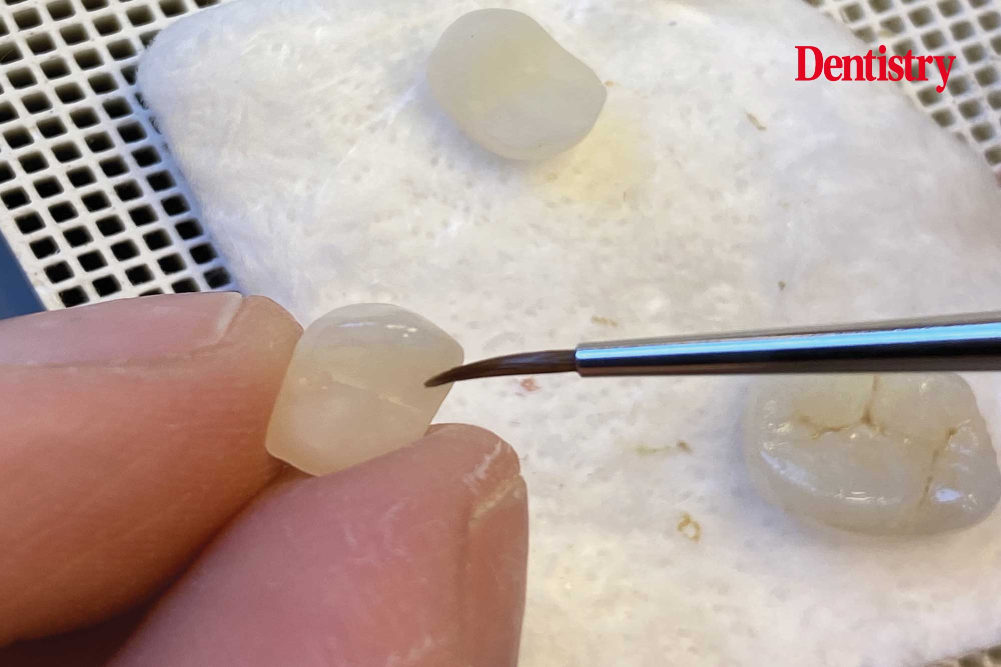 figure-64 Digital workflow: a game changer for implant restoration – part two