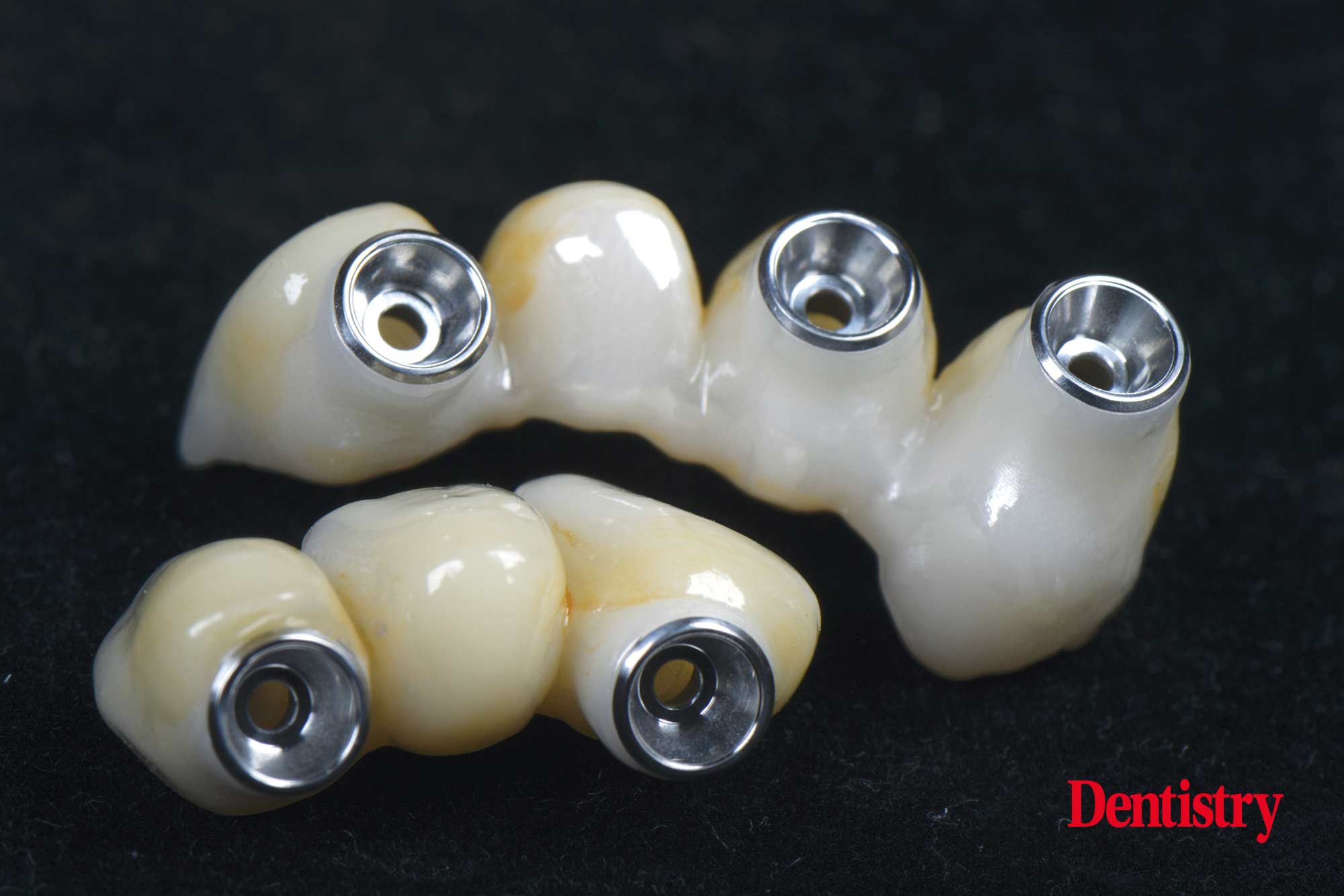 figure-69 Digital workflow: a game changer for implant restoration