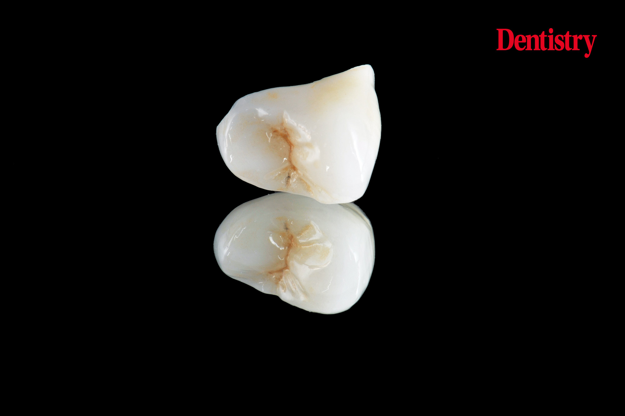 figure-75 Digital workflow: a game changer for implant restoration