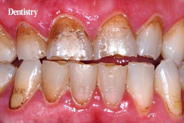 The history of oral health: a 25 year perspective