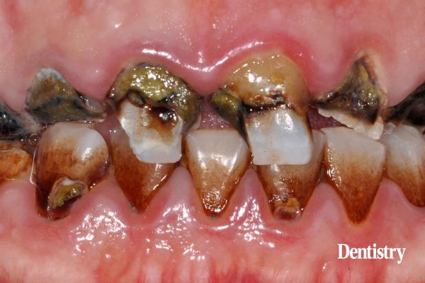 The history of oral health: a 25 year perspective
